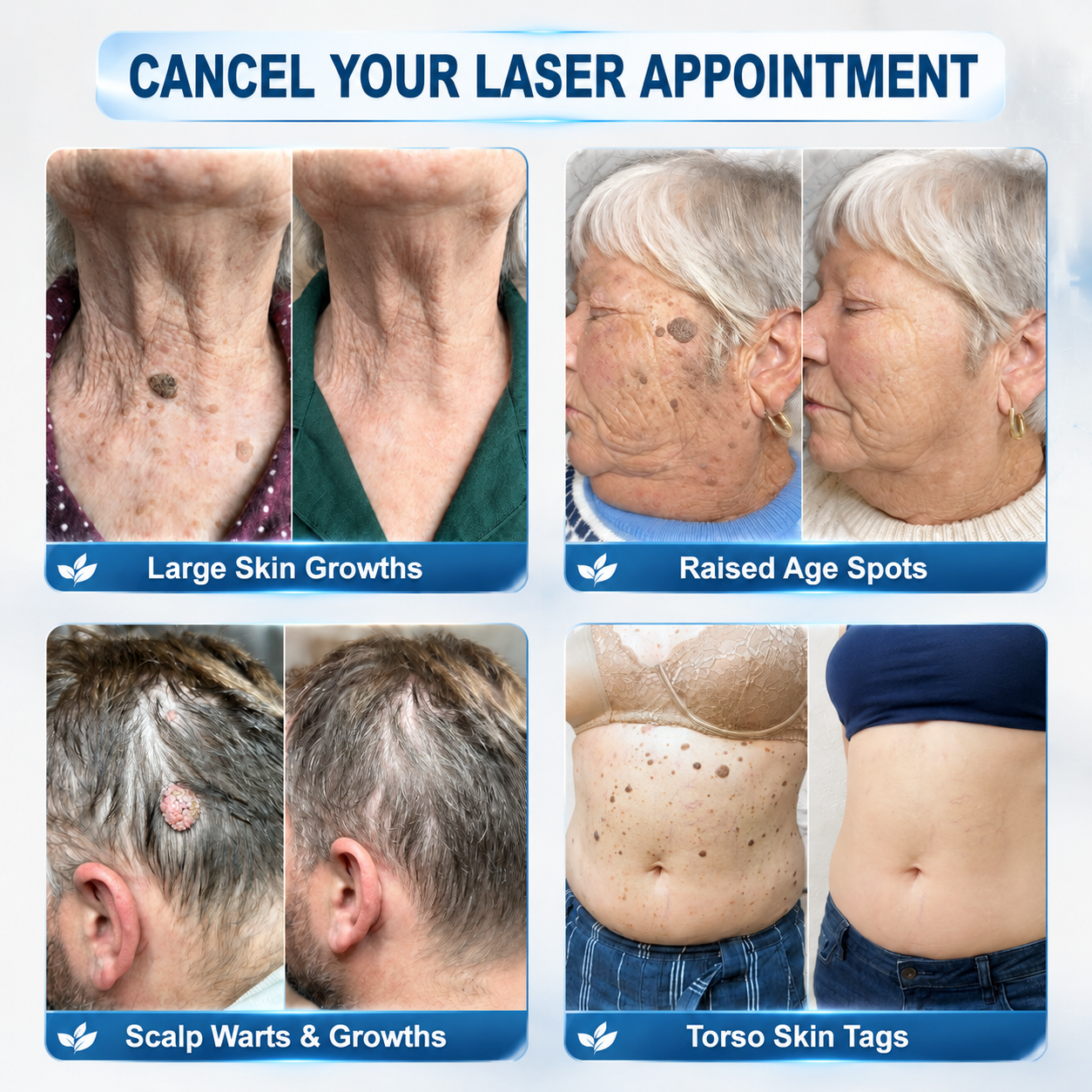 𝐎𝐟𝐟𝐢𝐜𝐢𝐚𝐥 𝐁𝐫𝐚𝐧𝐝 𝐒𝐭𝐨𝐫𝐞 |✅💎Hiskin ® 7-𝐷𝑎𝑦 𝗧𝐚𝐠 & 𝗦𝗽𝐨𝐭 𝐄𝐫𝒂𝒔𝒆𝒓(Zero Pain, Zero 𝐒𝐜𝐚𝒓𝒔 Rollerball)